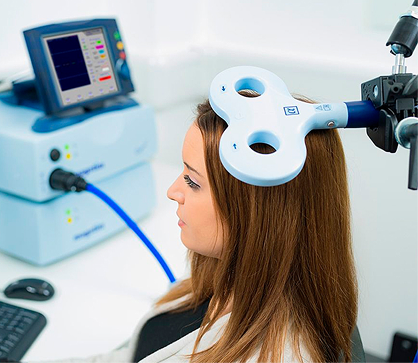 ESTIMULACIÓN MAGNETICA TRANSCRANEAL