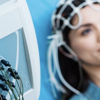 electroencefalograma-con-mapeo-cerebral.jpg